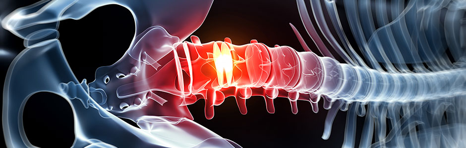 lower-back-and-neck-hernia-dr-emel-gokmen